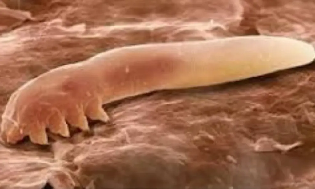 Demodex folliculorum (ácaros que fazem parte do microbioma humano)