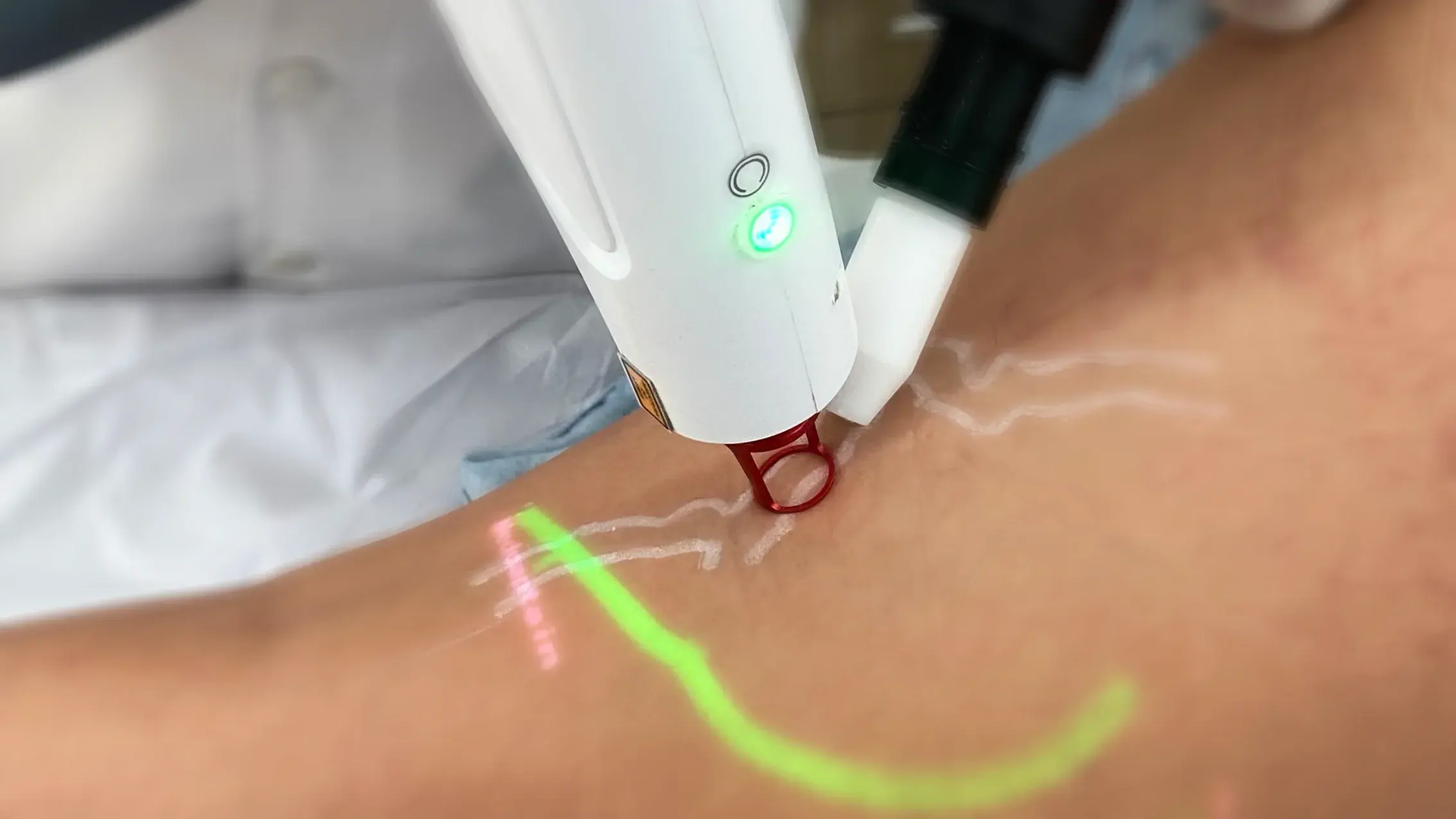 Angiologia e Cirurgia Vascular